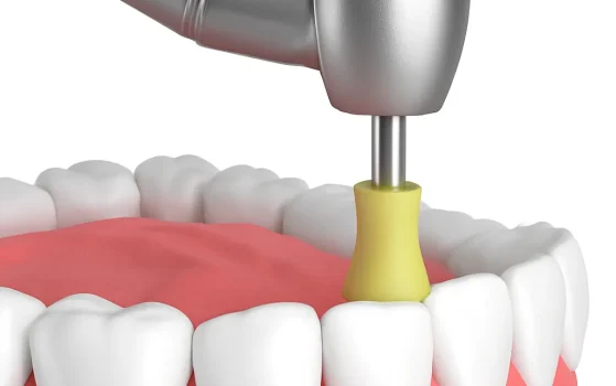 dental_cleaning_image dental_cleaning_image